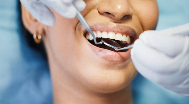 Best Cosmetic Emergency Dentistry in Polo, IL